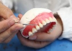 Cirurgia Guiada de Implante Dentário na Zona Leste, Anália Franco, Tatuapé SP. Implante Dentário Anália Franco, Implante Dentário Tatuapé, Implante Dentário Jardim Anália Franco, Implante Dentário Vila Gomes Cardim, Implante Dentário Vila Formosa, Implante Dentário Vila Carrão, Implante Dentário Zona Leste de SP